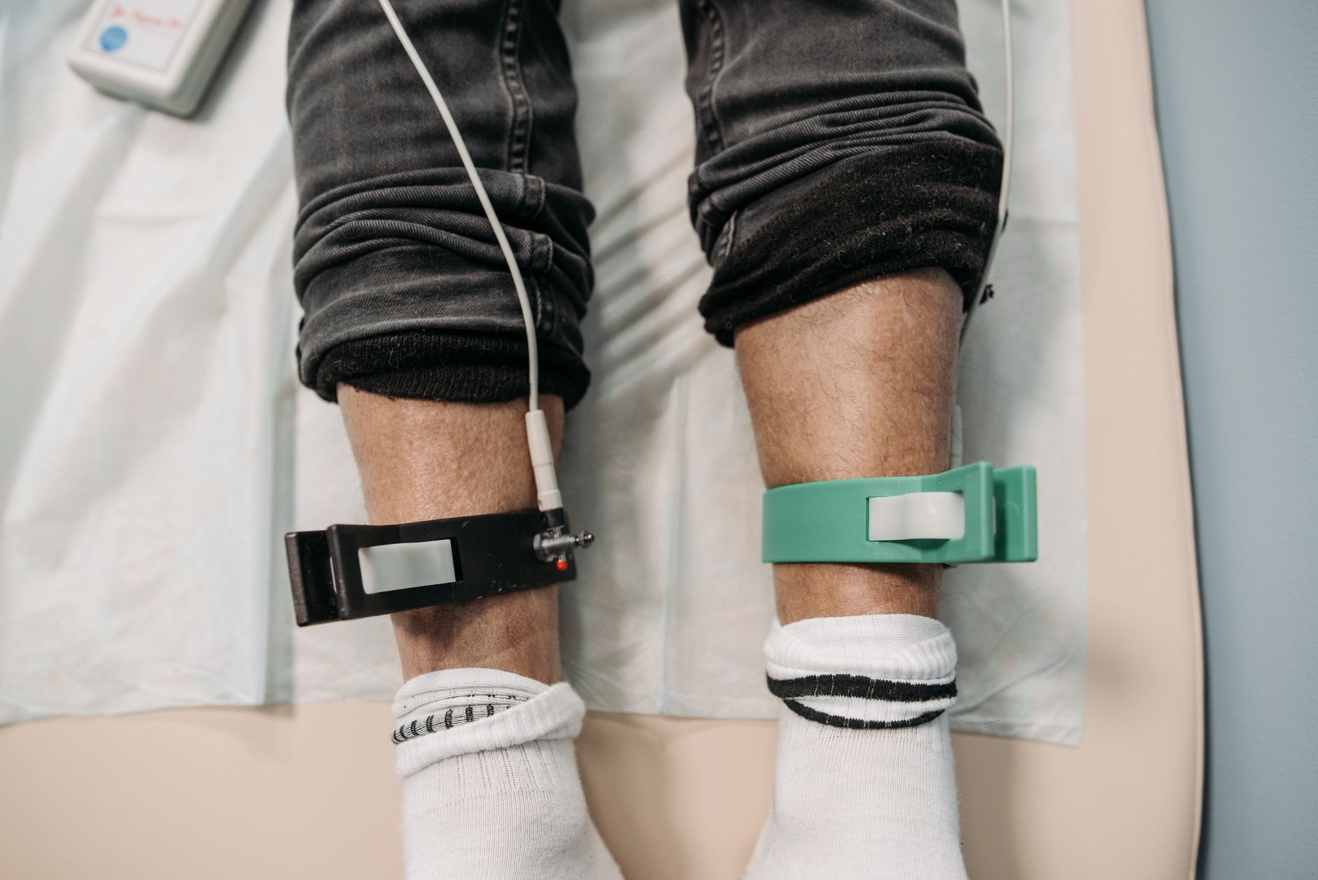 Does Epilepsy Qualify for SSDI and What Medical Criteria Must You Meet?
