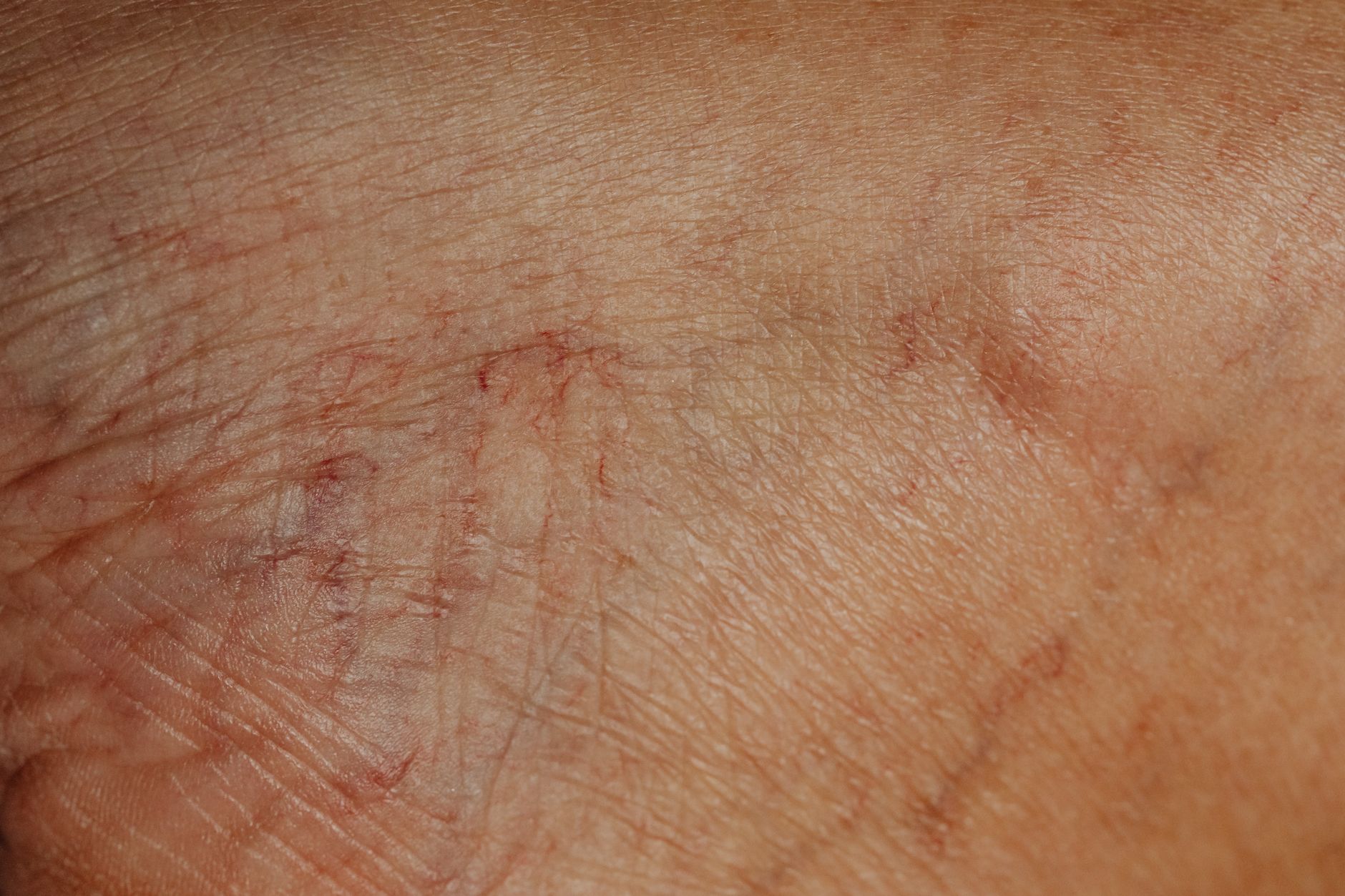 What Medical Conditions of the Back Qualify for Disability Benefits?