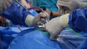 Ssdi for Spinal Cord Injury What You Need to Know - Featured image