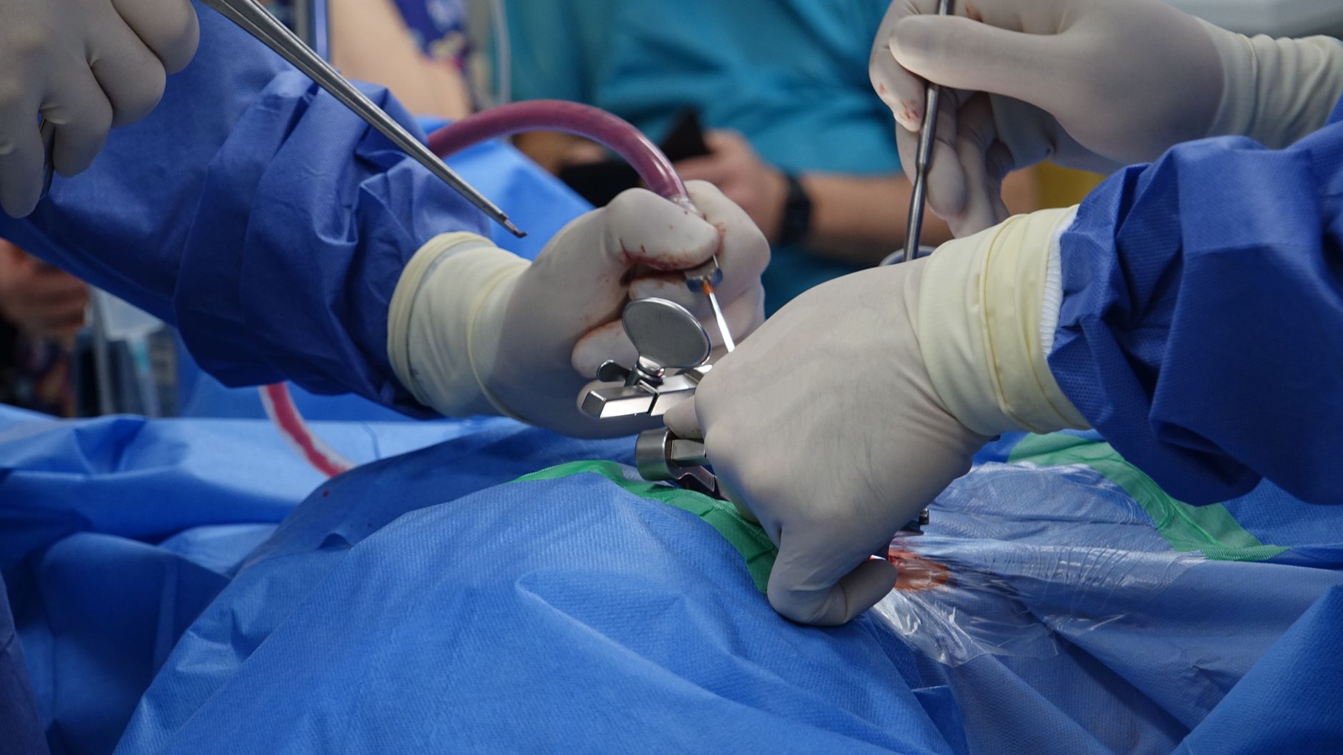 Ssdi for Spinal Cord Injury What You Need to Know - Featured image