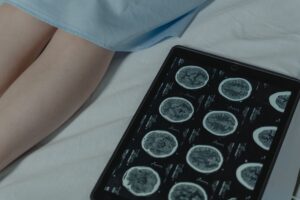Ssdi for Traumatic Brain Injury What You Need to Know - Featured image