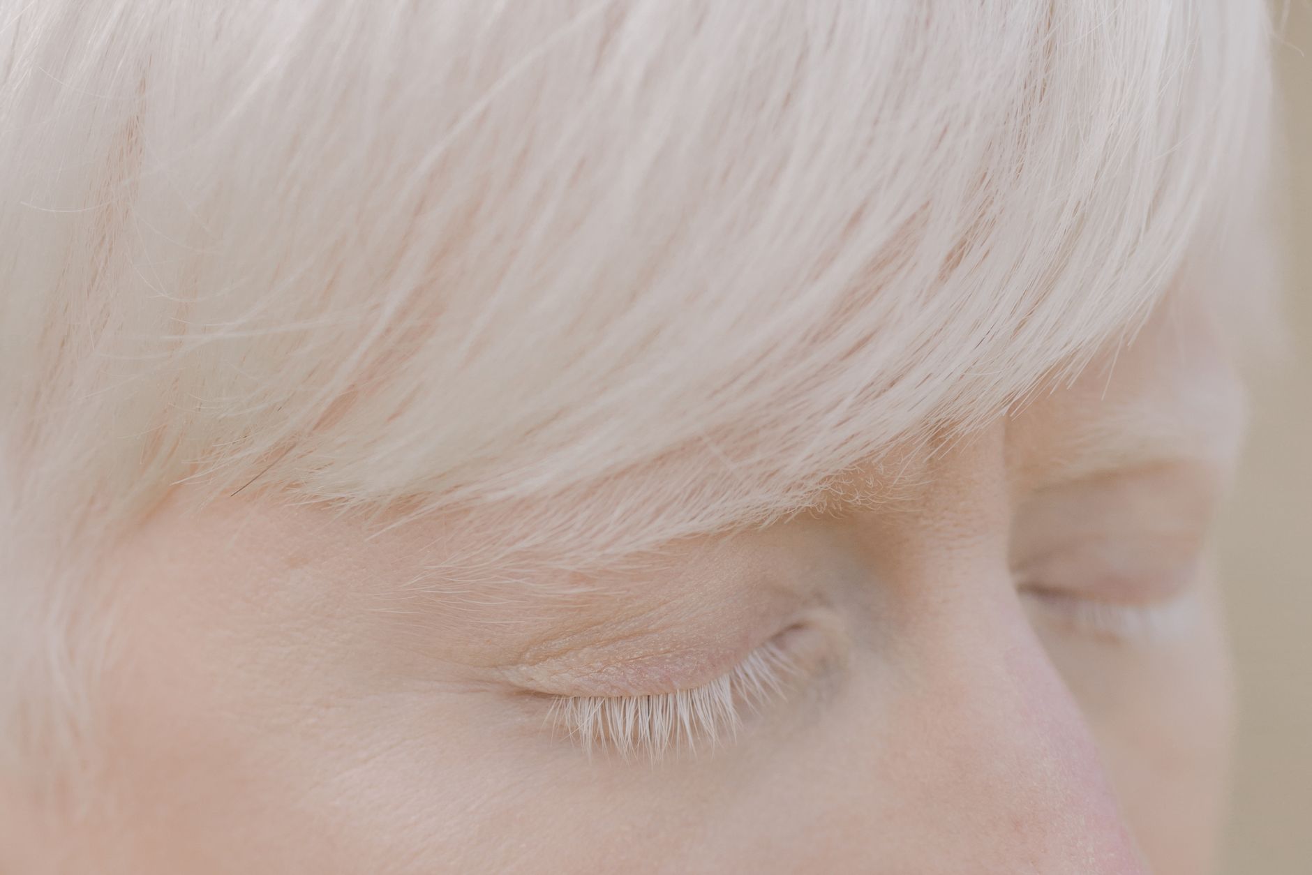 What Does the SSA Consider When Evaluating Autism for Disability?