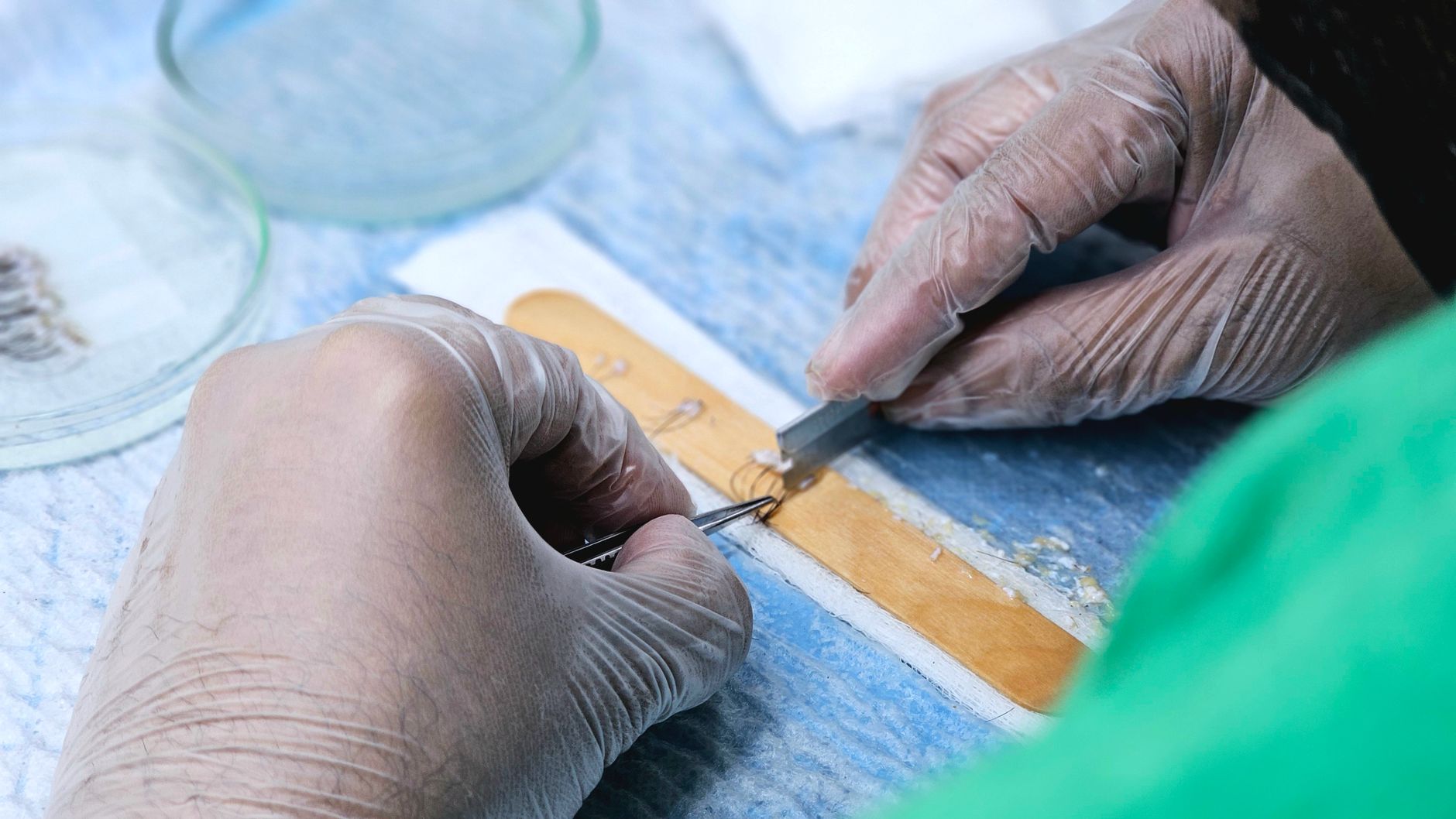 What Is the Medical Improvement Review Standard and How Does It Protect Beneficiaries?